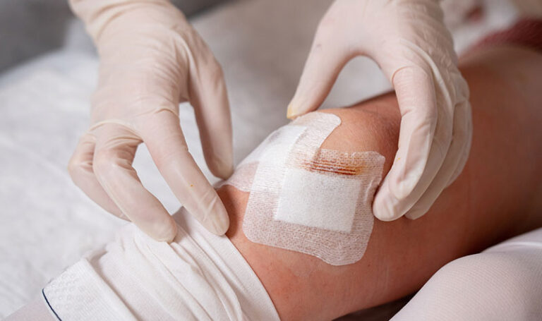 Wound Care Services