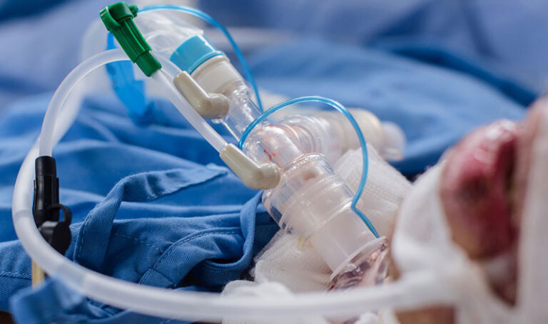 Tracheostomy & Oral Suctioning