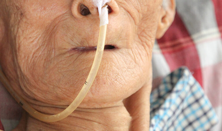 Insertion of Nasagastric Tube